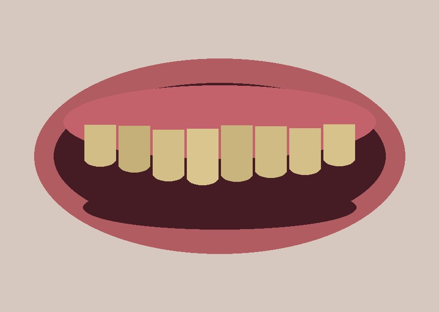 E.max veneers — 8 pcs — Before